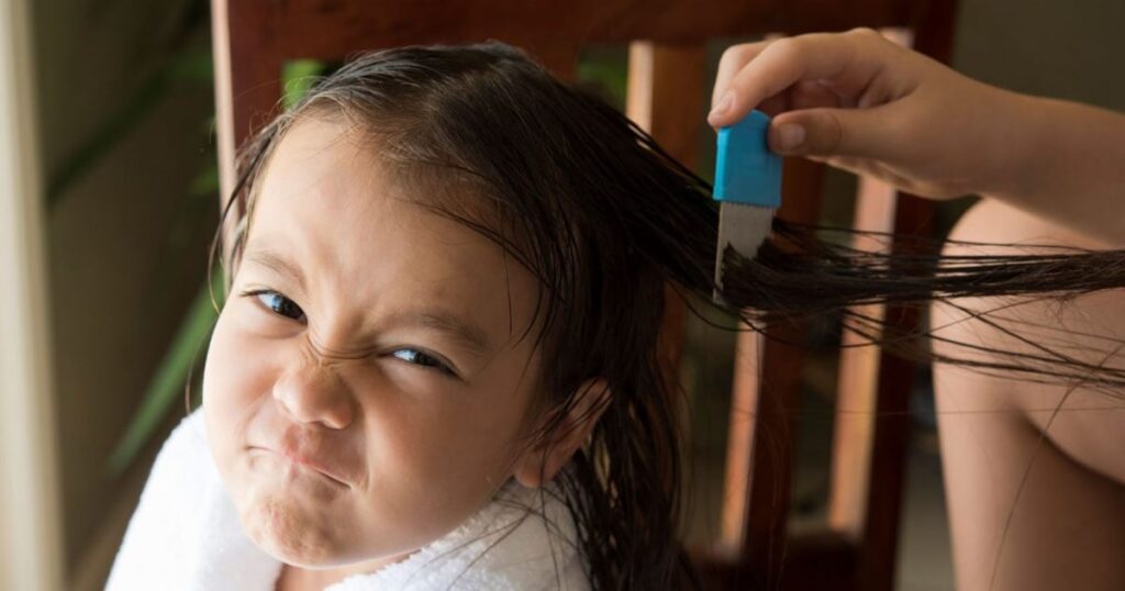 Une fillette de 4 ans gravement infectée par des poux a failli mourir-min