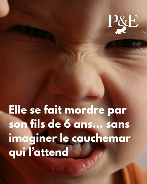 Elle se fait mordre par son fils de 6 ans-min
