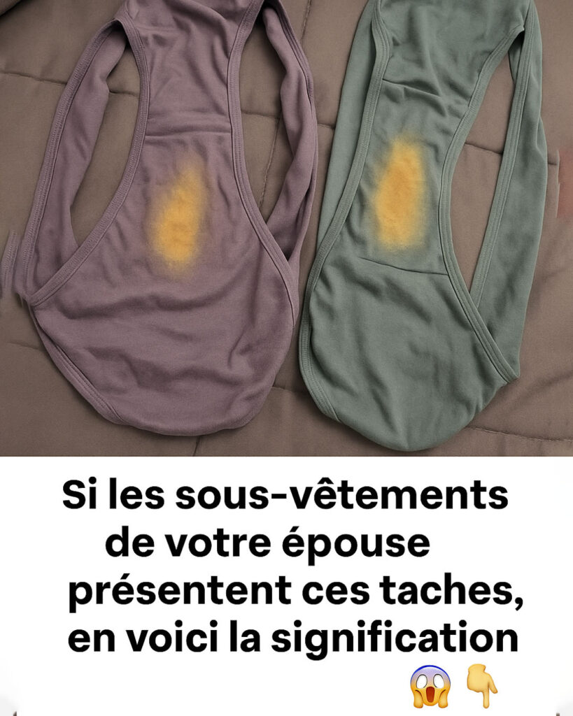 des taches sur le slip-min