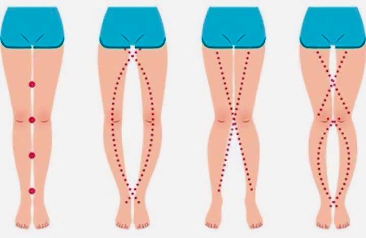 espacement jambe-min