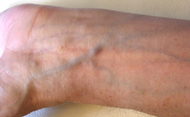 des veines bleues-min